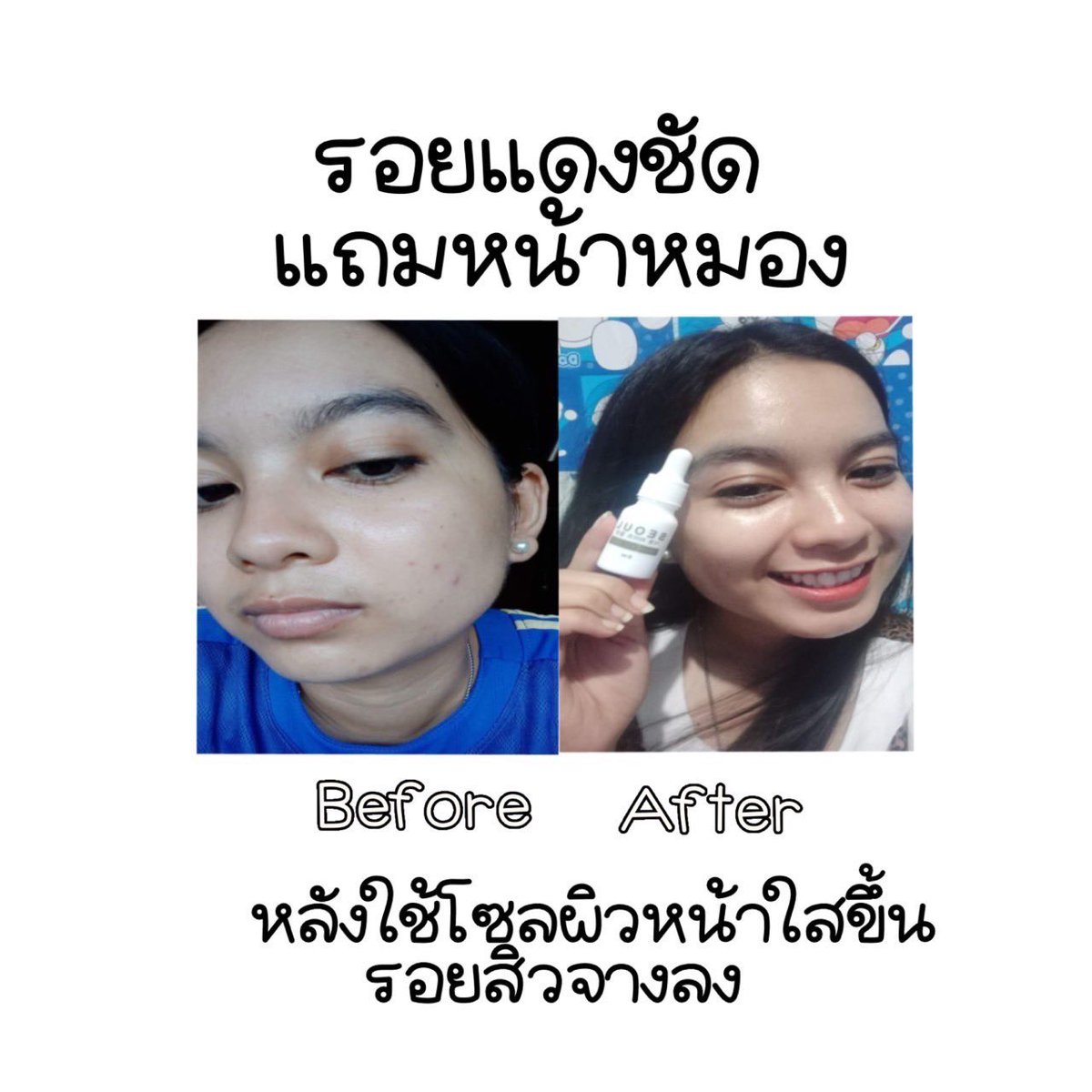 Pikk28423422's tweet photo. รีวิวดีต่อ💗💗
#เซรั่มโซล #เซรั่มออแกรนิค #เซรั่���ลดสิว #เซรั่มหน้าใส #หน้ากากอนามัย #หน้าแพ้แมส #เป็นสิว #ใช้ดีบอกต่อ #ใช้ดีบอกต่อสิว #ใช้เองรีวิวเอง #แคปชั่นเด็ด #แคปชั่นกวนตีน #แคปชั่นน่ารัก #แคปชั่นเสี่ยว #นัดรับ #แม่ค้าคนโสด #ของดีบอกต่อ #Serum #ขายของออนไลน์ https://t.co/YA1fmAv1uj