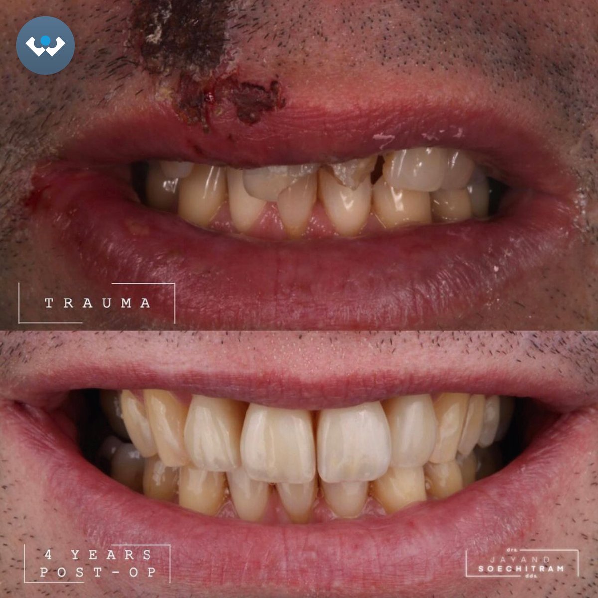 Excent Tandtechniek tweet media