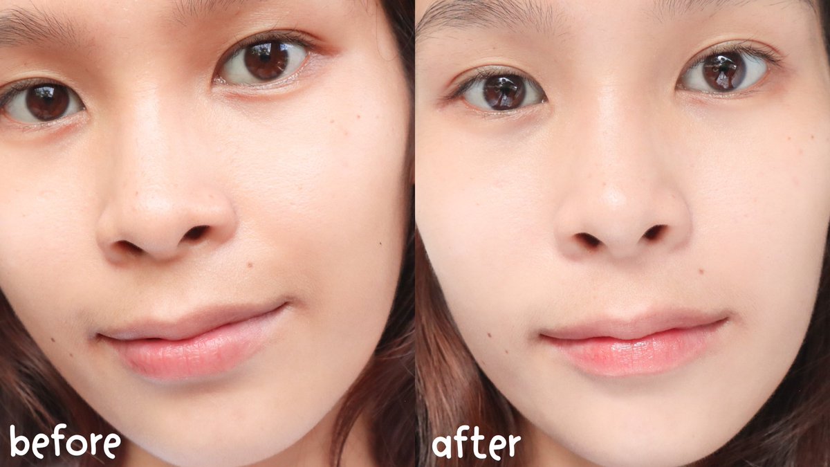 พอนด์สตัวใหม่ดีมาก เป็นครีมผสานกลูต้าบูสเซรั่ม ง่ายๆก็คือเป็นครีม+เซรั่ม ดีไปอีก นี่ลองแล้ว ผิวใสมาก เรื่องฝ้าแดด รอยดำต่างๆนางช่วยได้ด้วย ผิวเนียนขึ้น โคตรชอบ เนื้อไม่เหนอะด้วย สบายผิวมากใส่แมสไม่เยิ้มเลย ตอนนี้มีโปร 2 ซอง 20 ด้วย ต้องจัด พิกัด7-11เลยจ้า #ไว้รีวิวห้ามขายของโว้ยย