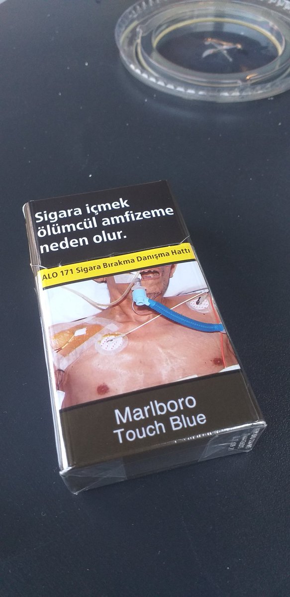 Taş mı kemirdin orospu çocuğu o dişler ne