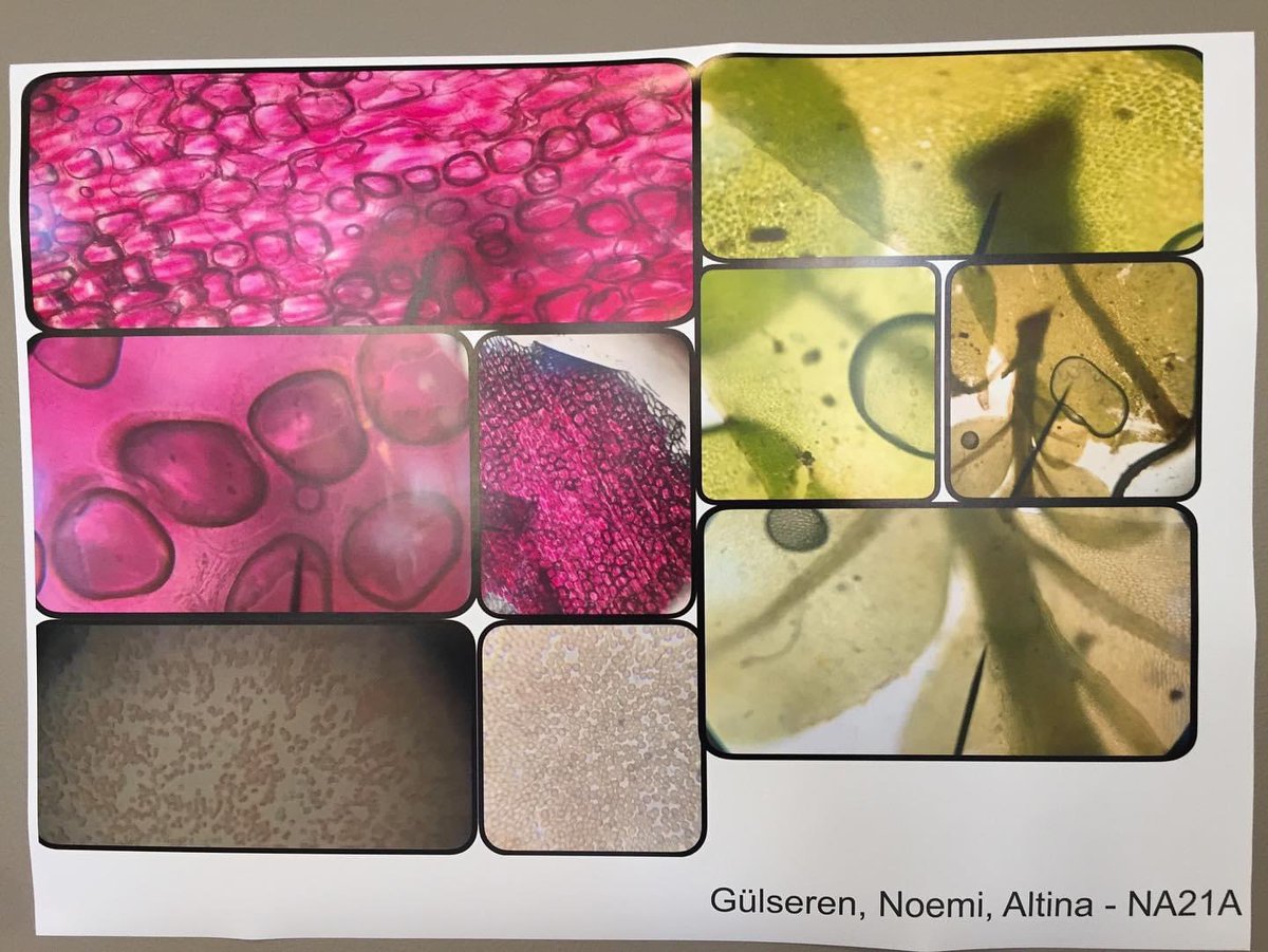 Elever på naturvetenskapsprogrammet ställer ut sina fina mikroskopbilder. 
🔬
Utställningen finns att beskådas i B2-korridoren. Klass NA21A har fotograferat och gjort den fina utställningen.