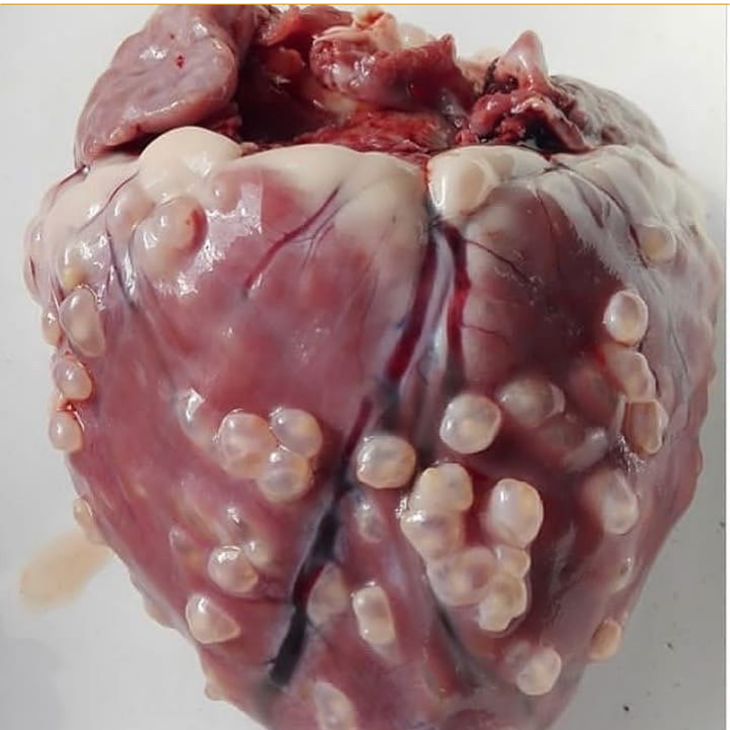 THE PORK YOU ARE EATING MIGHT BE EATING YOUR BRAIN AND HEART BACK...
Neurocysticercosis
Cysticercosis is the parasitic infection caused by taenia solium. The parasite can cause cysts in muscles, brain, or any tissue of the body.