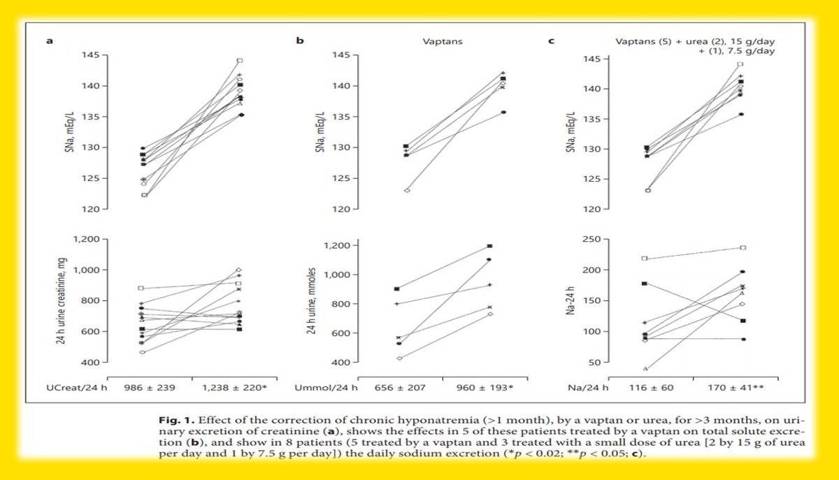 NephroKarger's tweet photo. Low Creatininuria due to Hyponatremia Is Reversible in Many Patients
✍ Guy Decaux
📄 https://t.co/C8FxqeuawI
#Nephron #️Hyponatremia #Sarcopenia #Creatininuria #Urea #Vaptans https://t.co/CR9lsnLbWl