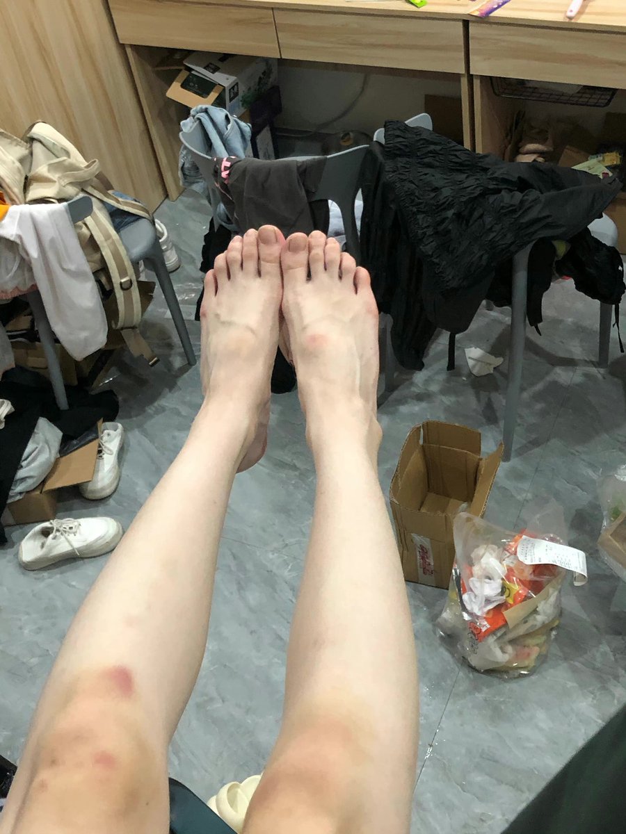 sladelouella's tweet photo. 把自己弄一身的伤！刚刚弄了一个小号，每天跟新自己的日常！想要的可以找我拿联系哦！

#反差婊 #母狗 https://t.co/P64sVtpAVG