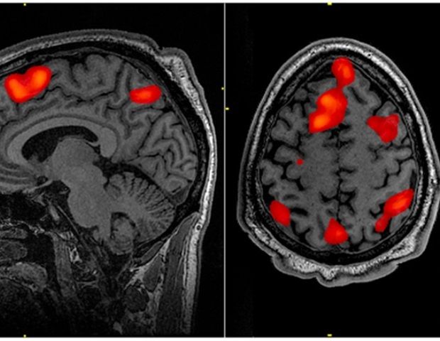 An interesting article on high-intensity exercise and how it affects sleep!
buff.ly/3oj8pS8
#Sleep #neuroscience #research