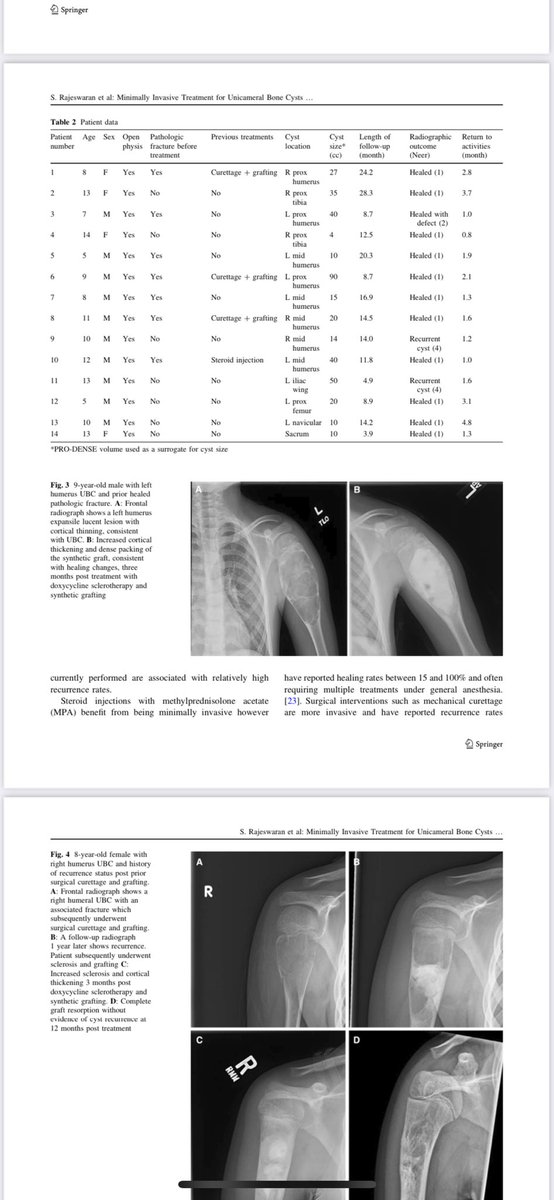 Elegant outpatient IR treatment for Pediatric Bone Cysts

readcube.com/articles/10.10…

<a href="/LurieRad/">Lurie Children’s Radiology</a> <a href="/NorthwesternIR/">NorthwesternIR</a> <a href="/CVIR_Journal/">CVIR Journal</a> <a href="/LurieChildrens/">Lurie Children's</a> <a href="/NURadiology/">Northwestern Radiology</a> <a href="/socpedsir/">SPIR</a> <a href="/SIRspecialists/">Society of Interventional Radiology</a> <a href="/JVIRmedia/">JVIR</a> <a href="/_backtable/">BackTable Vascular and Interventional</a>