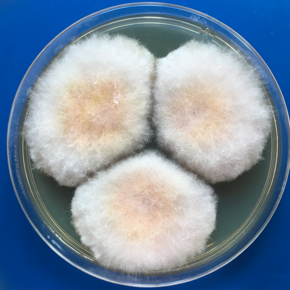 xmsunxhp's tweet photo. Eumycetoma， Fusarium solani https://t.co/aM1KYj2CIi