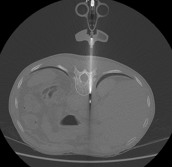 DrDavidMcKean's tweet photo. Our MSK &amp; Spinal Radiology Fellowship is now open : https://t.co/Br1ghYhM7h
Join our enthusiastic and supportive team! Please get in touch for more information @BucksHealthcare @BucksRadiology @BSSR_Site https://t.co/eidU81tIoy