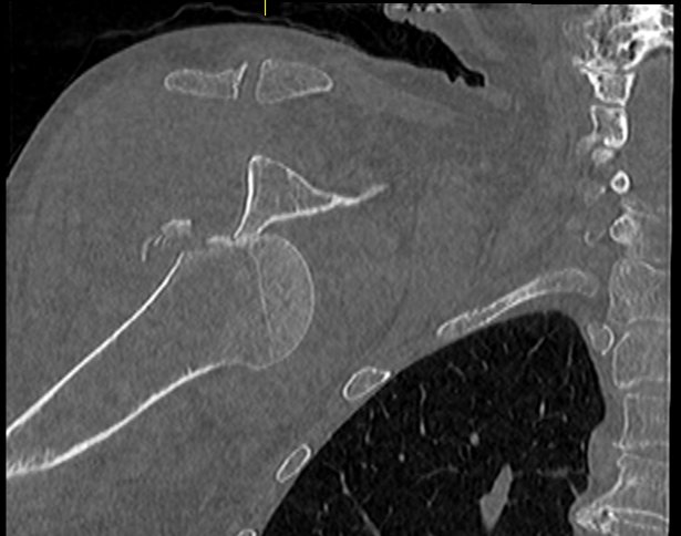 DrDavidMcKean's tweet photo. Our MSK &amp; Spinal Radiology Fellowship is now open : https://t.co/Br1ghYhM7h
Join our enthusiastic and supportive team! Please get in touch for more information @BucksHealthcare @BucksRadiology @BSSR_Site https://t.co/eidU81tIoy
