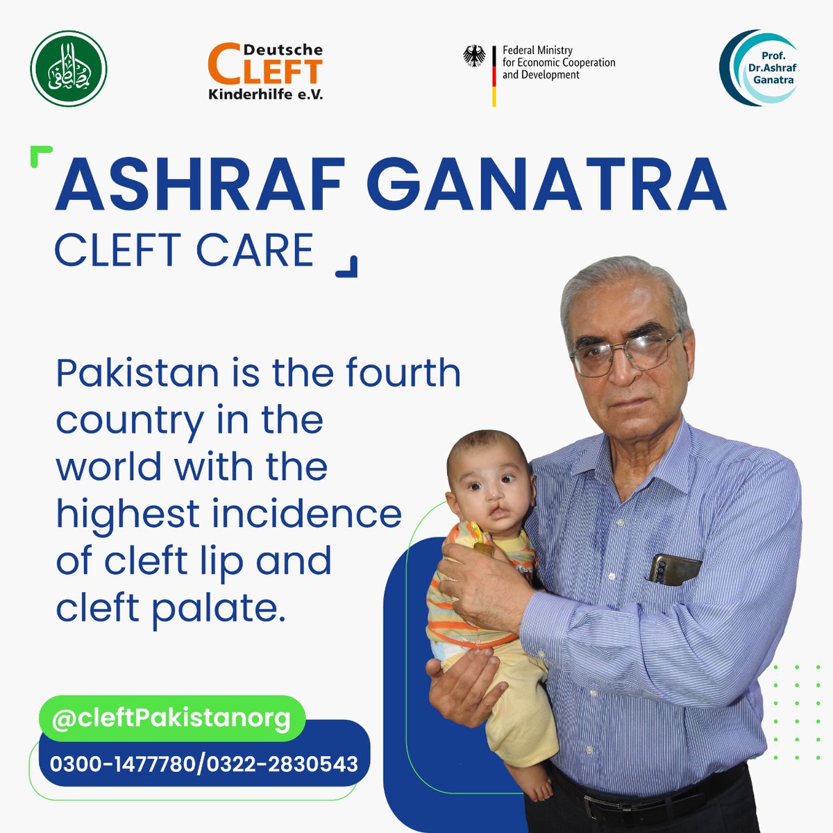 cleftpakistan's tweet photo. Pakistan is the fourth country in the world with the highest incidence of cleft lip and cleft palate.

- Dr Ashraf Ganatra
Like and Share the Post
Spread the Word
Support the Cause.
Ashraf Ganatra Cleft Care is treating Cleft Lip and Cleft Palate for free,#1in500 #cleftawareness https://t.co/ZBRoRgMMHz