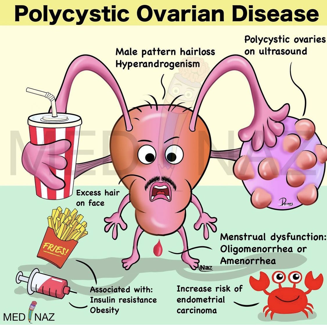 __mnemonics's tweet photo. PCOS :

#obygyn : https://t.co/oWwyje39wY