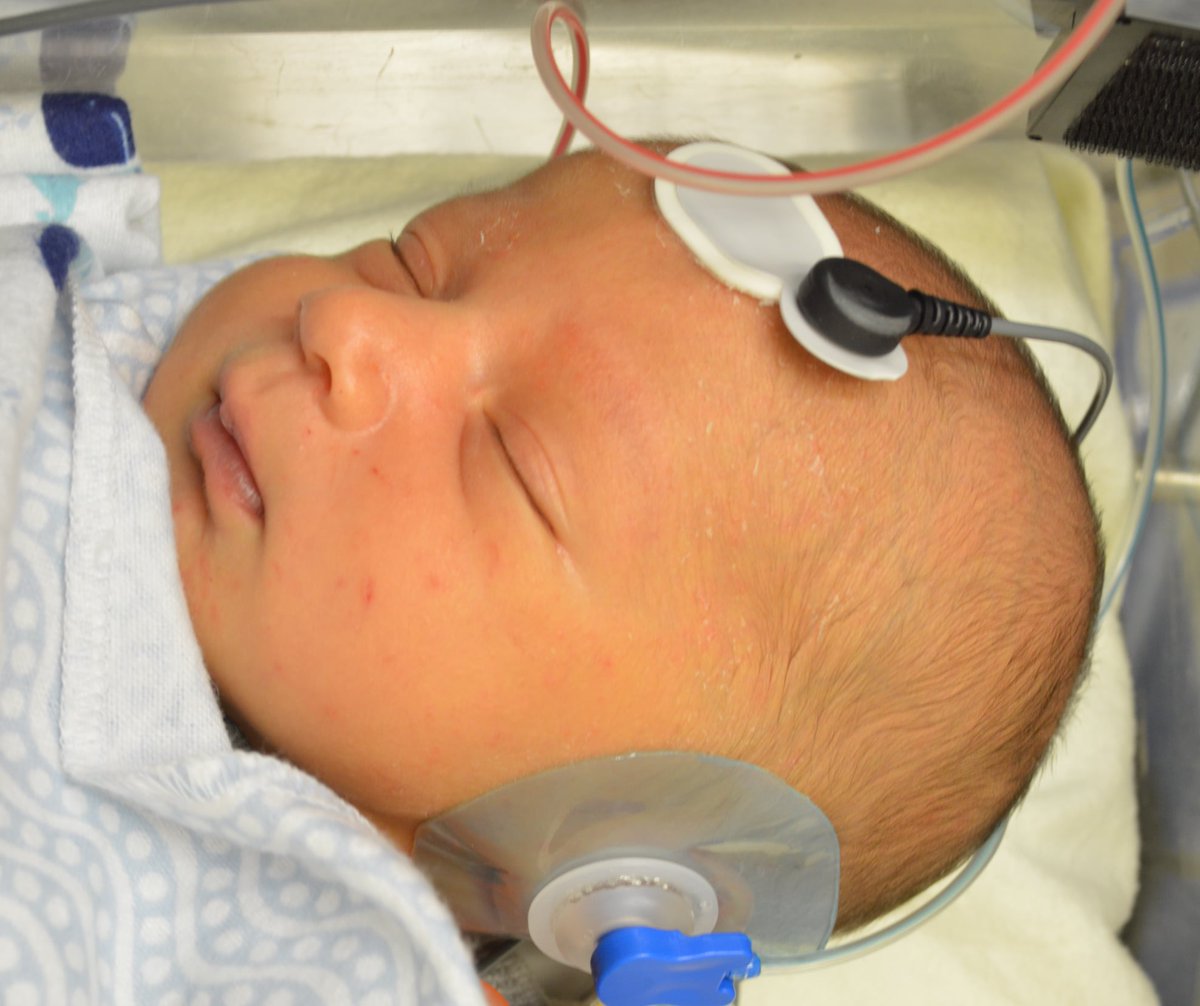 Lizzy_Simpson's tweet image. Dr. Elizabeth Simpson (@LizzySimpson) - I study early infant social cognitive development in humans &amp;amp; monkeys, including studies of #NeonatalImitation &amp;amp; #FacePerception. I longitudinally track infant behavior (e.g., eye-tracking) &amp;amp; physiology (e.g., oxytocin, ABR). /9