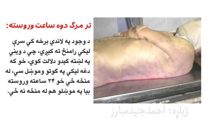 mnoormuslim's tweet photo. د‌ خپل ځان په اړه فکر وکړئ!
له مرګ وروسته به مو جسد په کوم حالت کې وي؟
دلته يې وګورئ او فکر وکړئ! https://t.co/yGx55mkNZk