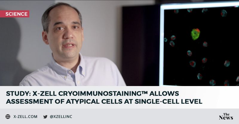 X-ZELL (@xzellinc) on Twitter photo RESEARCH UPDATE – New data published at the European Congress of Pathology has shown that <a href="/XZELLInc/">X-ZELL</a>'s Cryoimmunostaining technology could serve as a simple and efficient solution to measure the #DNA content of a cell. Full publication here: ow.ly/G8rN50Go8zU #pathology RESEARCH UPDATE – New data published at the European Congress of Pathology has shown that <a href="/XZELLInc/">X-ZELL</a>'s Cryoimmunostaining technology could serve as a simple and efficient solution to measure the #DNA content of a cell. Full publication here: ow.ly/G8rN50Go8zU #pathology