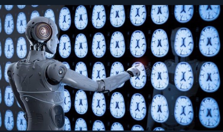 Yn bleser cael bod yn cydweithio gyda King’s College Llundain i ddatblygu system AI er mwyn helpu darllen MRI o’r ymenydd. Fel PI, rydym nawr ar agor ac yn recriwtio ar draws Gogledd Cymru #MIDIstudy <a href="/BetsiResearch/">BetsiResearch</a> <a href="/ResearchWales/">Health and Care Research Wales</a>