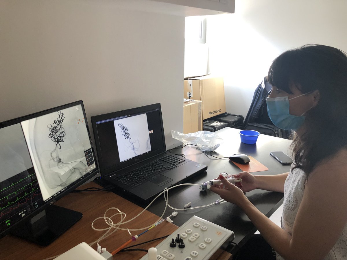 Isabel Fragata (@isabelfragata) on Twitter photo Neurovascular intensive course day 2! Learning about AVMs and AVFs with Alberto Gil and <a href="/_AdnanSiddiqui/">Adnan H. Siddiqui, MD</a> . #mentice #ahed Neurovascular intensive course day 2! Learning about AVMs and AVFs with Alberto Gil and <a href="/_AdnanSiddiqui/">Adnan H. Siddiqui, MD</a> . #mentice #ahed