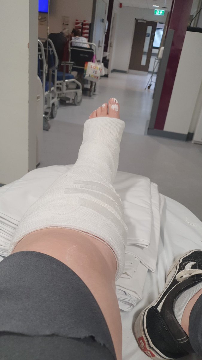 LucyGardRN's tweet photo. Bagged myself a Webber B ankle fracture yesterday walking the dog... 👍🐕 Really can't say enough good things about the care I've recieved these past 2 days from my colleagues in @EDSRFT1 and fracture clinic. You guys are fabulous and so hard working, truly stars 🌟 https://t.co/Ozj36NqZkr