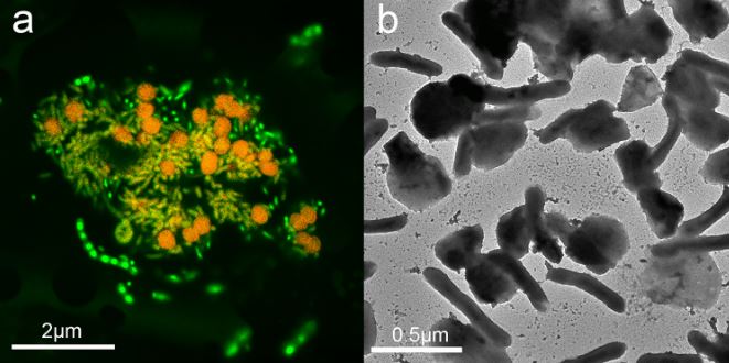 Methanosarcina Acetivorans