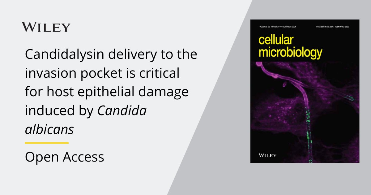 WileyLifeSci's tweet image. Selene Mogavero &amp;amp; team trace the steps of #Candidalysin from fungus to host.

Read this @CellMicrobiol Editor's Choice Microreview: ow.ly/CRvE50GpVJh

#OpenAccess