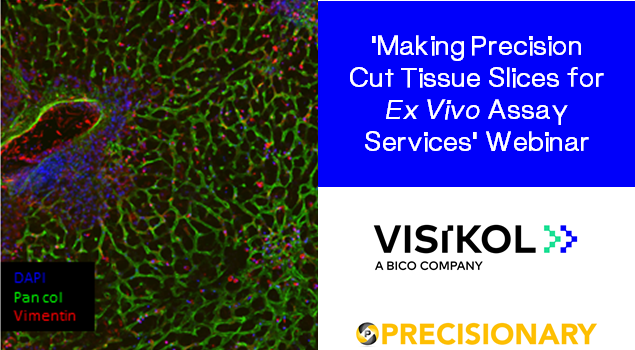 Visikol's tweet image. Missed @Visikol's webinar on Precision Cut Tissue Slices with Precisionary Instruments?

Watch it here --&amp;gt; hubs.ly/H0Z3FmK0

#Visikol #PCLS #Webinar #Jointhebioconvergencerevolution