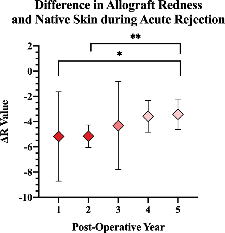 This proof-of-concept study demonstrates that software-based analysis can detect and monitor acute rejection changes in #FaceTransplantation.
<a href="/mdorant1/">Miguel I. Dorante, MD, MBE</a>
#face #transplant #plasticsurgery #microsurgery
<a href="/JRM_JRMOpen/">JRM|JRMOpen</a> 
<a href="/pomahacMD/">pomahacMD</a>
<a href="/BranislavKollar/">Branislav Kollar, MD</a> 
bit.ly/3lz3Xgj
