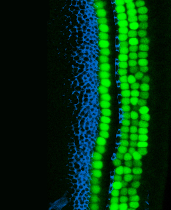 NeuronTrees's tweet image. &apos;USC Stem Cell scientists explore the latent regenerative potential of the inner ear&apos;

Also thanks to fish for evolving gills that became in our ear to hear.

__
eurekalert.org/news-releases/…