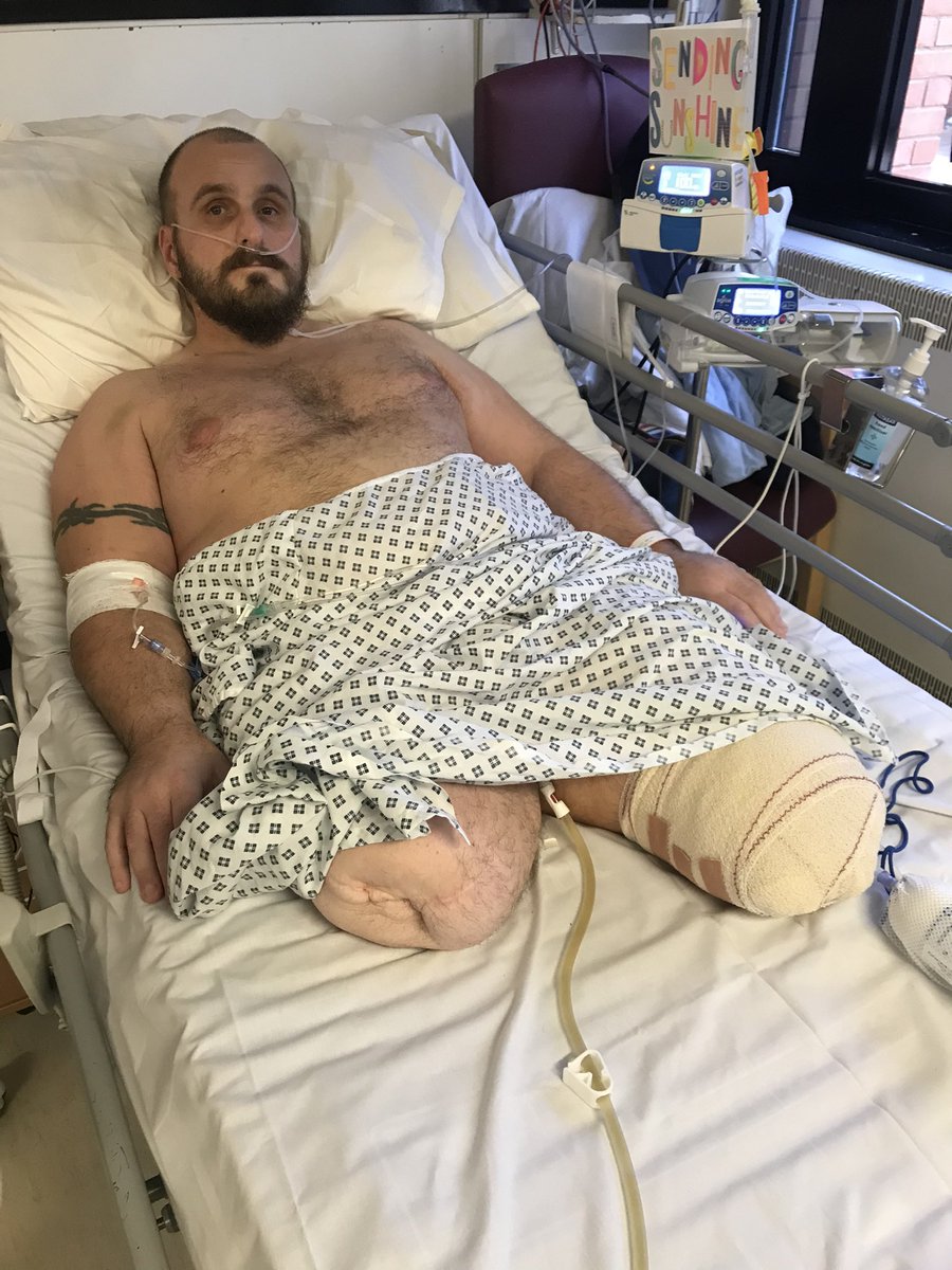 Was One Leg Wonder tweet media