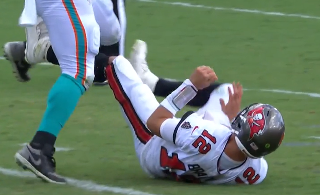 Greg Auman on X: "Brady hit his right thumb on the helmet of Dolphins  defensive end Christian Wilkins after making a 12-yard throw to Cam Brate  with 4:11 left before halftime Sunday.