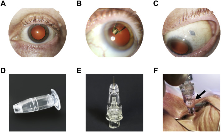 Ophthalmology tweet media