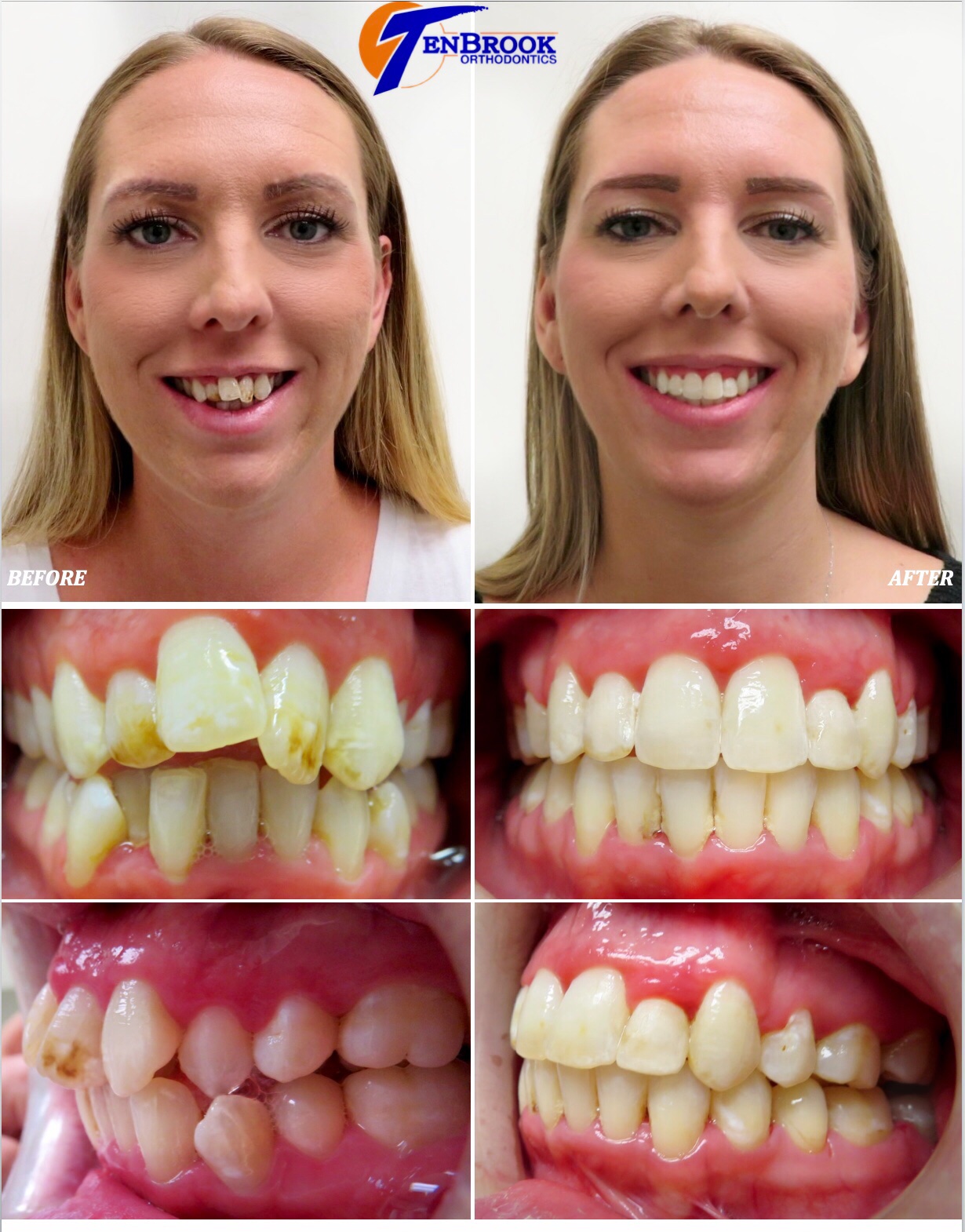 TenBrook Orthodontics on Twitter "🌹 At TenBrook Orthodontics Dreams Do