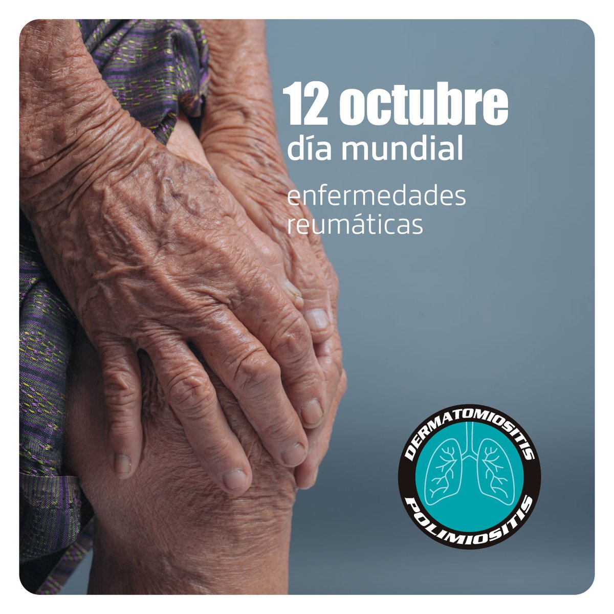 dermatomiositi1's tweet photo. Hoy 12 de octubre es el día mundial de las enfermedades reumáticas.
#dermatomiositis #polimiositis #raredisease #reuma #reumatología https://t.co/nmH0hTdvjg