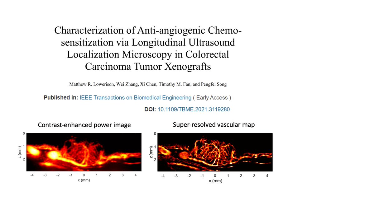 Another exciting #superresolution #ultrasound imaging study published in IEEE TBME! These amazing vascular images revealed combination therapy effects between chemotherapy and anti-angiogenic agents on colorectal carcinoma tumors. doi.org/10.1109/TBME.2…