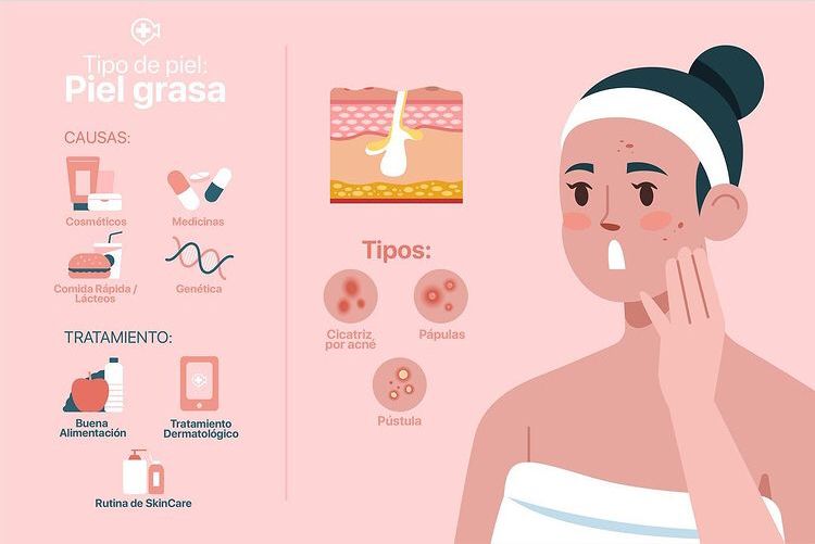 MyNextDerma's tweet photo. Levanten la mano todas las personas con este tipo de piel🙋‍♀️🙋‍♀️
¿Causas?¿Tipos?
Te lo explicamos todo 😉 #MyNextDerma https://t.co/m4yf1RAy6l