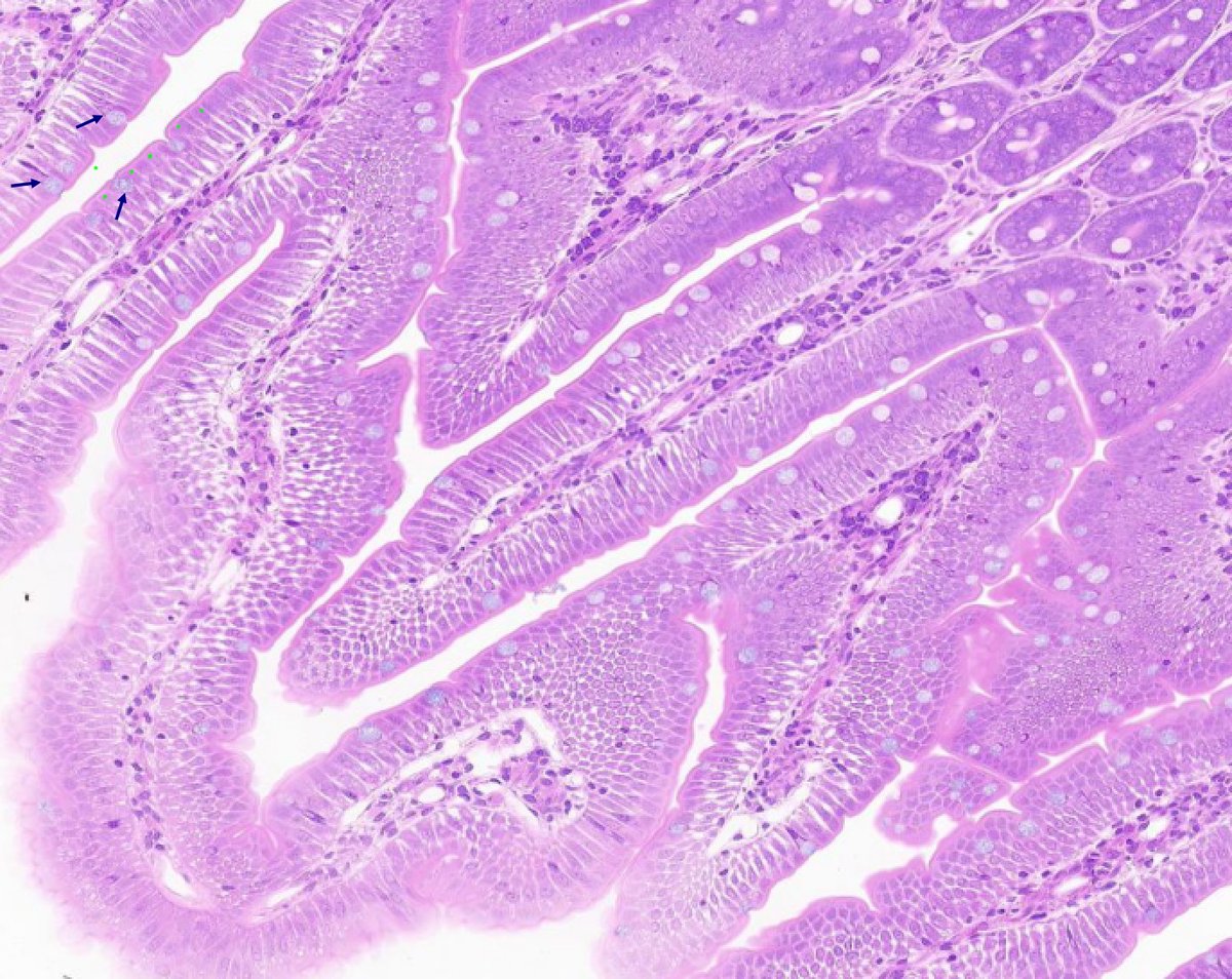 HistologyHome's tweet photo. GI System Histology: Tweetorial #2

Topic: Histology of the Esophagus

Pop Quiz (poll in next tweet): What type of muscle is found throughout the length of the muscular layer of the esophagus?

#HistoHQ

1/17 https://t.co/HmExkgGs9j