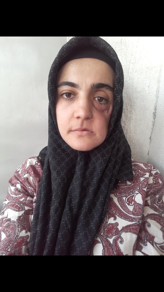 Emine Erdem (@emineer56800191) on Twitter photo 2 buçuk yıldır babasından ayrı.Annesi Ağır bir ameliyatla tanınmayacak hale geldi.4.Evre kanser hastası annesi 2.kez cezaevinde.
Ayşe Özdoğanın oğlunda davranış bozuklukları başladı.Çocuk psikyatrı ilaç tedavisi başlayacak.
<a href="/adalet_bakanlik/">T.C. Adalet Bakanlığı</a>
<a href="/ADLITIPKURUMU/">Adli Tıp Kurumu</a>
#AyşeÖzdoğan 2 buçuk yıldır babasından ayrı.Annesi Ağır bir ameliyatla tanınmayacak hale geldi.4.Evre kanser hastası annesi 2.kez cezaevinde.
Ayşe Özdoğanın oğlunda davranış bozuklukları başladı.Çocuk psikyatrı ilaç tedavisi başlayacak.
<a href="/adalet_bakanlik/">T.C. Adalet Bakanlığı</a>
<a href="/ADLITIPKURUMU/">Adli Tıp Kurumu</a>
#AyşeÖzdoğan