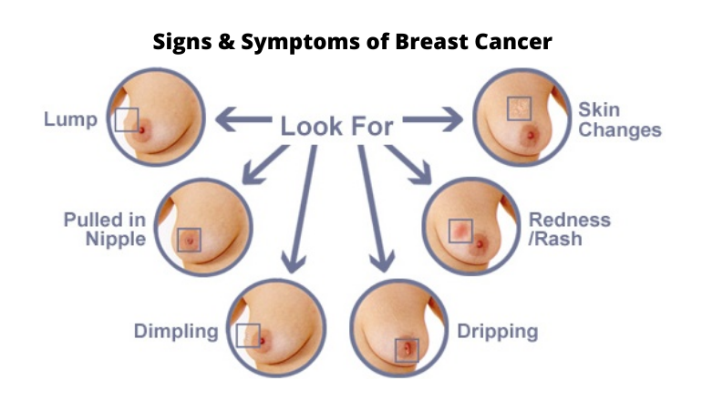 BWGovernment's tweet photo. SYMPTOMS OF BREAST CANCER

Signs and symptoms of breast cancer may include:

• A breast lump or thickening that feels different from the surrounding tissue
• Change in the size, shape or appearance of a breast

#AwarenessWednesday
#BreastCancerAwarenessMonth https://t.co/qQtgSyg8nk