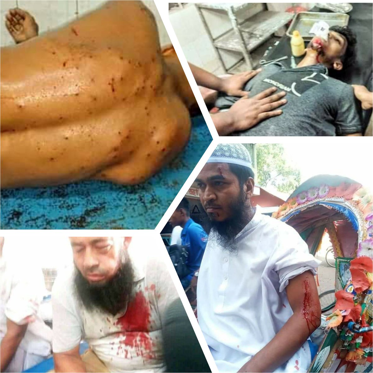__FDI__'s tweet photo. After insulting the Holy Quran in Durga puza people of Comilla got angry and start to protest.

Police fired bullet to the protestor and made many people injured.
#Islamophobia https://t.co/bHVJRjFiA8