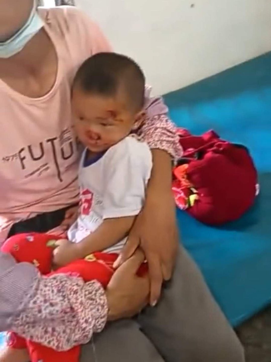 hannayuri_twt's tweet photo. Over 400 locals from three villages in Shan State’s Muse Township have been displaced since Tuesday by fighting between junta troops and a local ethnic armed group. Six civilians, including two toddlers, were injured in Tuesday’s clash. (Photo: CJ) 

#WhatsHappeningInMyanmar https://t.co/UT8wqefnfj