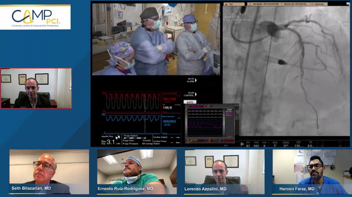 LAzzaliniMD's tweet image. What a complex case on #CampPCI performed by
@PaulMahoneyMD, @MSummersMD and Paul Lavigne.
Multivessel, severely calcified CAD. LVEF 45%. #Transcaval #Impella and #RotaTripsy on LAD with 1.5 mm burr and 2.5 mm @ShockwaveIVL.
Great discussion! @eruizrodz1 @HaroonFarazMD @DrSethdb