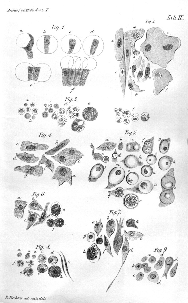 StoriaMedicina's tweet photo. "Omnis cellula e cellula": Rudolf L. K. #Virchow, the father of #cell theory, was born #OTD exactly 200 years ago. His name is also linked to the pathogenesis of #thrombosis, on which he published a treatise in 1845.
#histmed #MedTwitter #medizin #science #historiamedica #storia https://t.co/M1GpyjIeGS