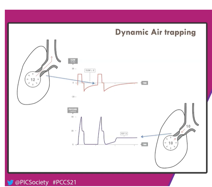 some4mv's tweet photo. RT @PICJournalWatch: .@lberto_Medina on his favourite #SoMe4MV topics #Ventilation #ObstructivePattern #TimeConstant
#PCCS21 #PedsICU https://t.co/No3tr7fn5Q