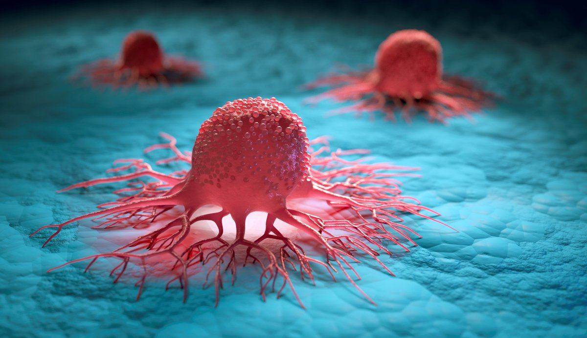 Follow us on The Cancer Revolution. Read on characteristics which cancer cells acquire during the development of tumors. Learn more on challenges ahead for cancer therapy. apeiron-biologics.com/the-cancer-rev… #Cancer #Oncology #CancerResearch #CancerAwareness