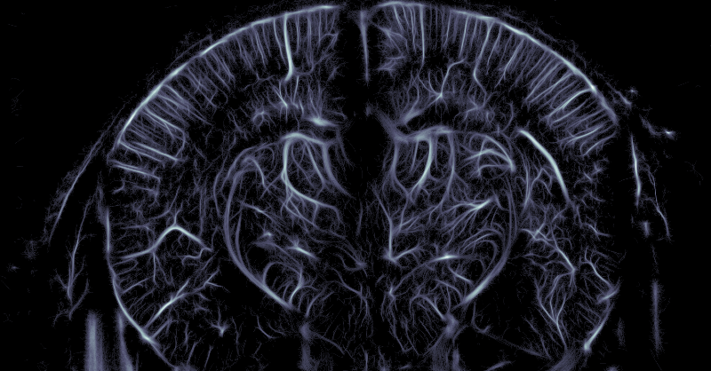 iconeus's tweet photo. We're hiring! We're looking for our next Application Specialist to work alongside Drs. Jérémy Ferrier and Soumee Bhattacharya. If you're passionate about all things neuroscience, get in touch! 🧠
Details below ⬇️
#nowhiring #neurosciencejobs #sciencejobs #neurojobs #fUS