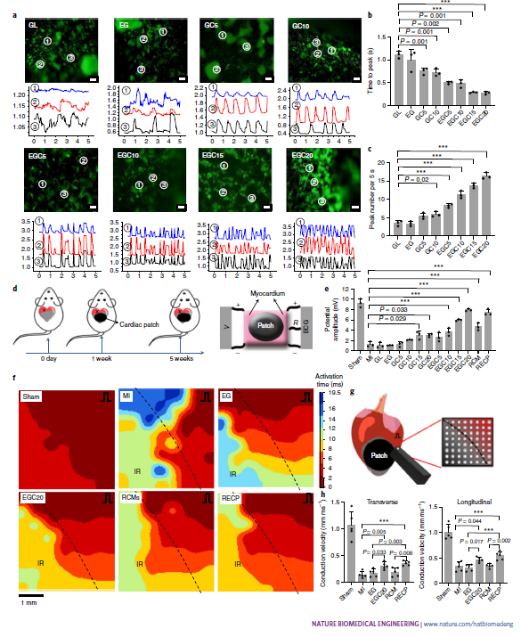 MappingLab_EP's tweet photo. Wang et. al. (2021) reported shape-memory cardiac patches for the functional repair of cardiac tissue after MI.
The electrical mapping system was used to examine the electrical propagation on the #Langendorff perfused rat #hearts with cardiac patches.
https://t.co/Qp25wPhANp https://t.co/3oeenuYTHQ