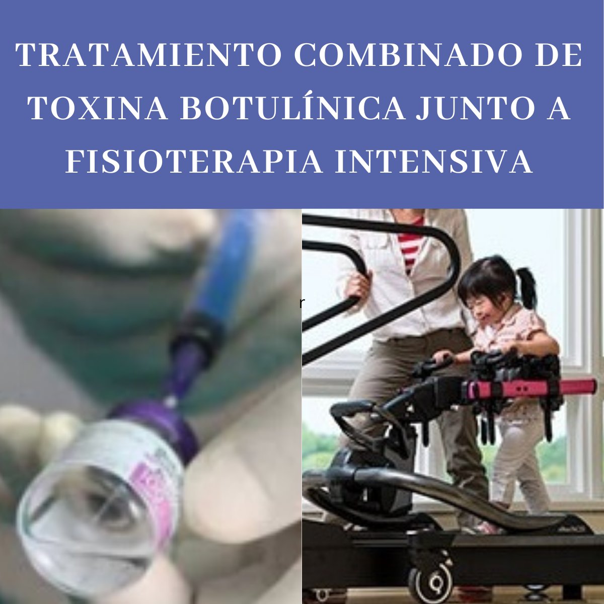 efisiopediatric's tweet photo. #fisioterapeutas  En muchas ocasiones se realizan tratamientos que combinan la toxina botulínica con la fisioterapia intensiva ¿Es necesaria esta combinación? 

https://t.co/MQWyxCTwC8 https://t.co/6d6SGcWZZp