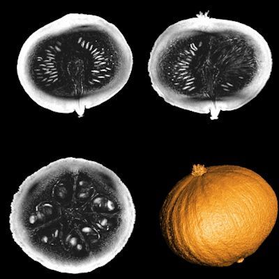 AuntMinnieEuro's tweet photo. BREAKING NEWS: exclusive interview with @denislb about the 11.7 Tesla MRI scanner, its first images and the @NeuroSpin_91 team's future goals and plans. https://t.co/AzDOU5mWZe #radiology #highfieldmri #esmrmb https://t.co/aXTMPxB5ZG