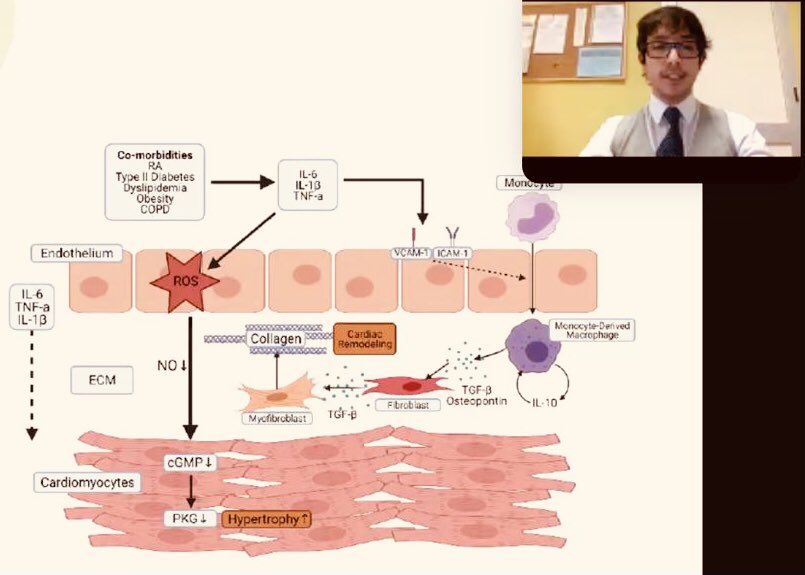 Sim_Orizon's tweet image. 👉Rheumatic Diseases and Physical Activity #Reumasport ⛷⛹🏻🏌️‍♀️🤾🏼‍♀️🧘🏼🤽🏿🧗🏽‍♀️🏊🏼
🚨Heart failure in #rheumatoidarthritis. Systemic inflammation is has a crucial role in the #cardiacremodelling already in the early stages of the disease 😱
#TGFbeta #Fibroblast #Stiffness