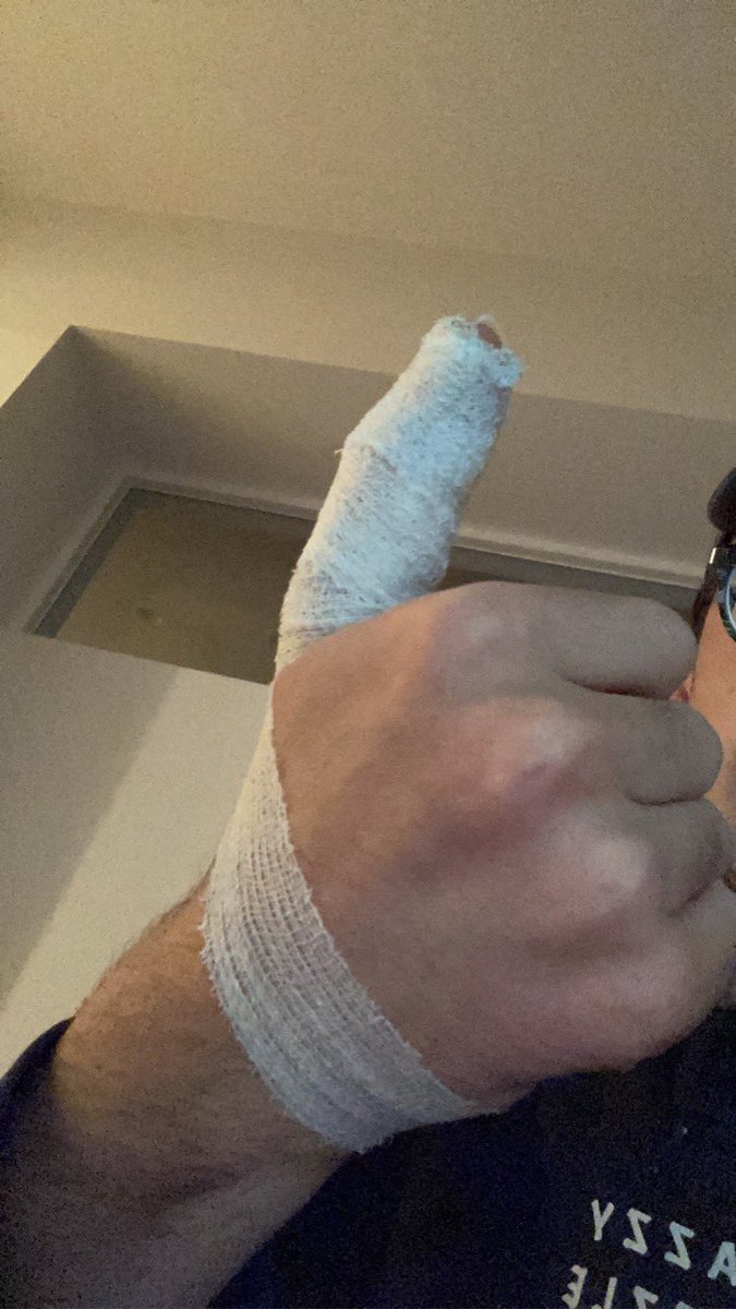 Na 3 jaar stilliggen opnieuw met veel goesting meetrainen met mijn oude volleybalclub. Breek ik mijn duim in het eerste kwartier. Great great great.