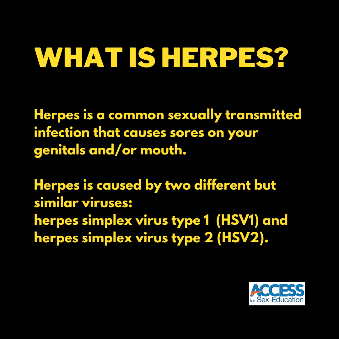 AccessforSexEd's tweet photo. This #HerpesAwarenessDay let's talk about what herpes is, how it happens, and how it is treated.
#AccessForSexEd #SexEd #Herpes #Awareness #StopTheStigma #STI https://t.co/zj8ROS6kTl