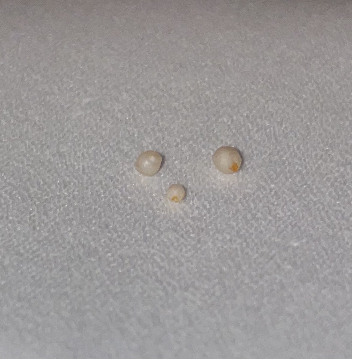 So I’ve just eaten some mussels and clams in a restaurant and felt something hard in one of them…

Upon further investigation…is it possible that mussels or clams can have pearls in them? 🤔